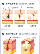 仁和药业 防脱发育发液30ml 油脂性脱发 护发固发头皮护理