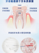 舒适达抗敏感专业修复 NovaMin技术牙膏专业牙齿修复10