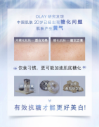 玉兰油（OLAY）抗糖小白瓶精华液50ml光感小白瓶升级版抗
